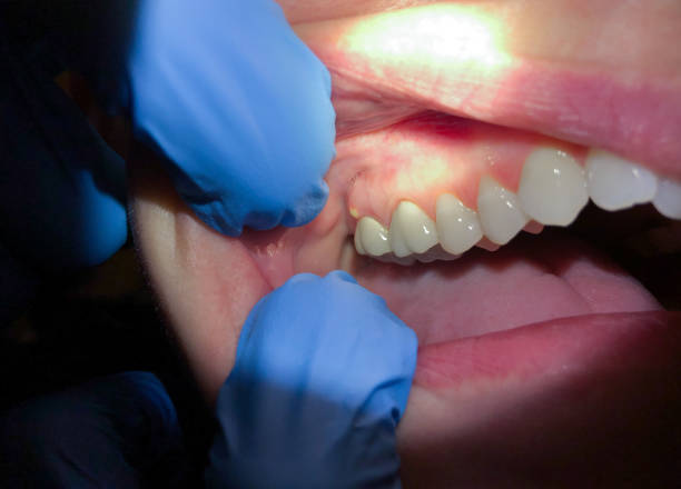 Best Emergency Gum Pain Relief  in Ladysmith, WI