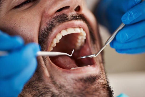 Best Dentist for Tooth Abscess  in Ladysmith, WI